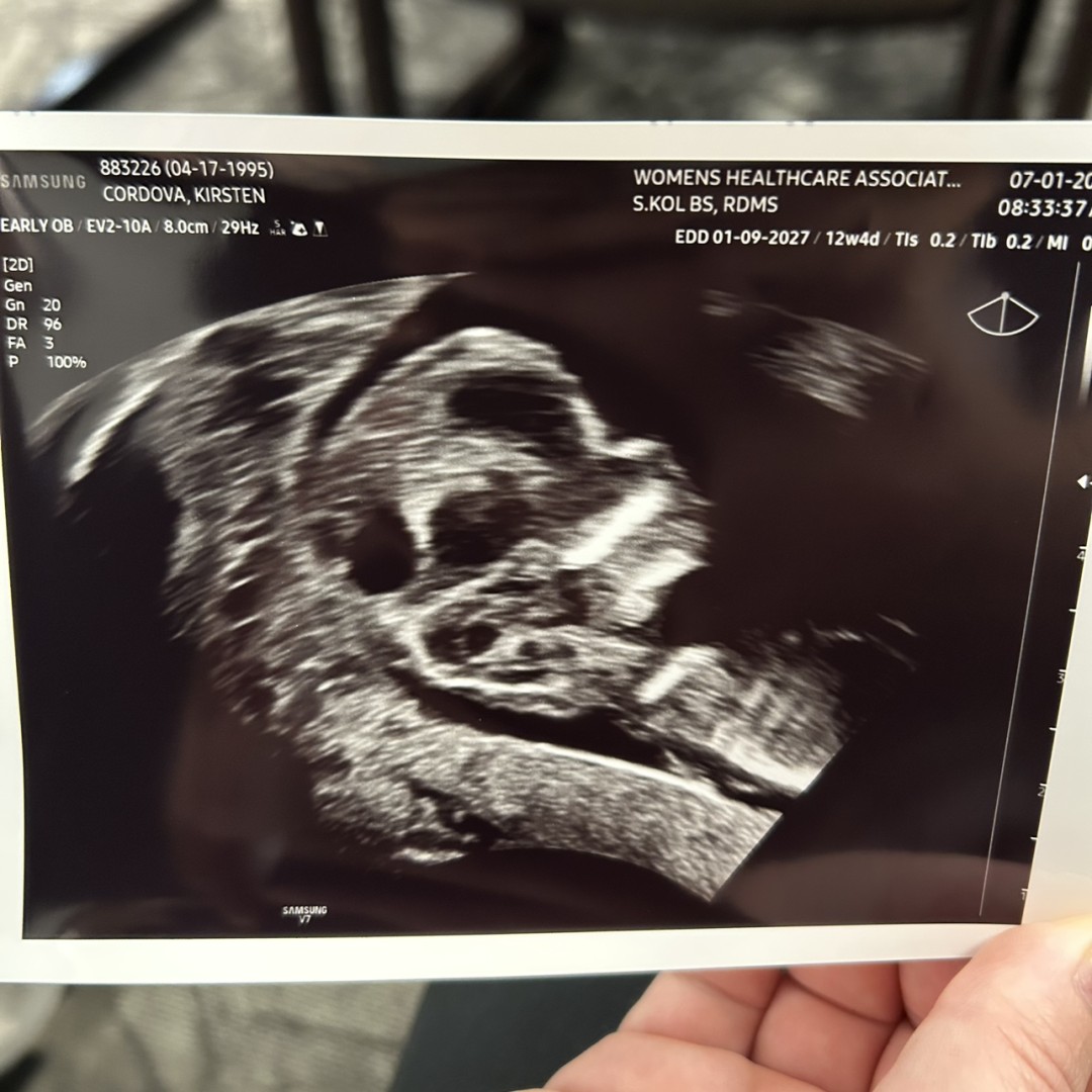 Photo shared by Kirsten for their Babylist baby registry.