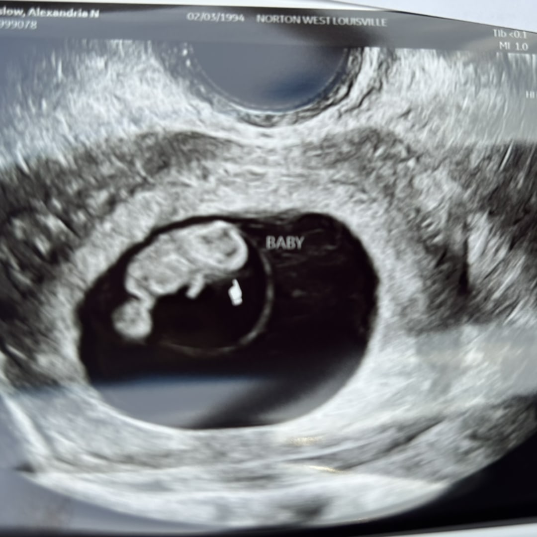 Photo shared by Aly for their Babylist baby registry.