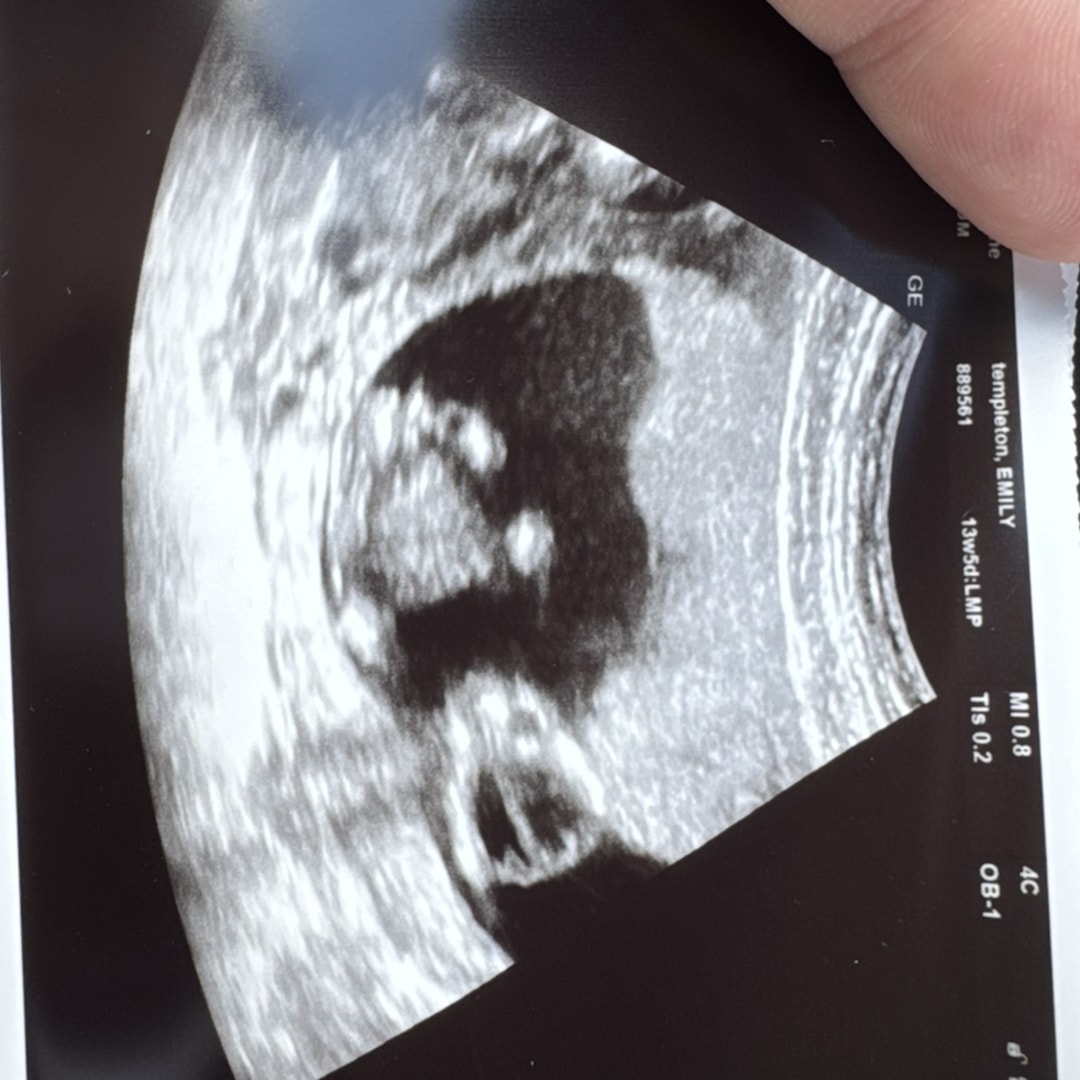 Photo shared by Emily for their Babylist baby registry.