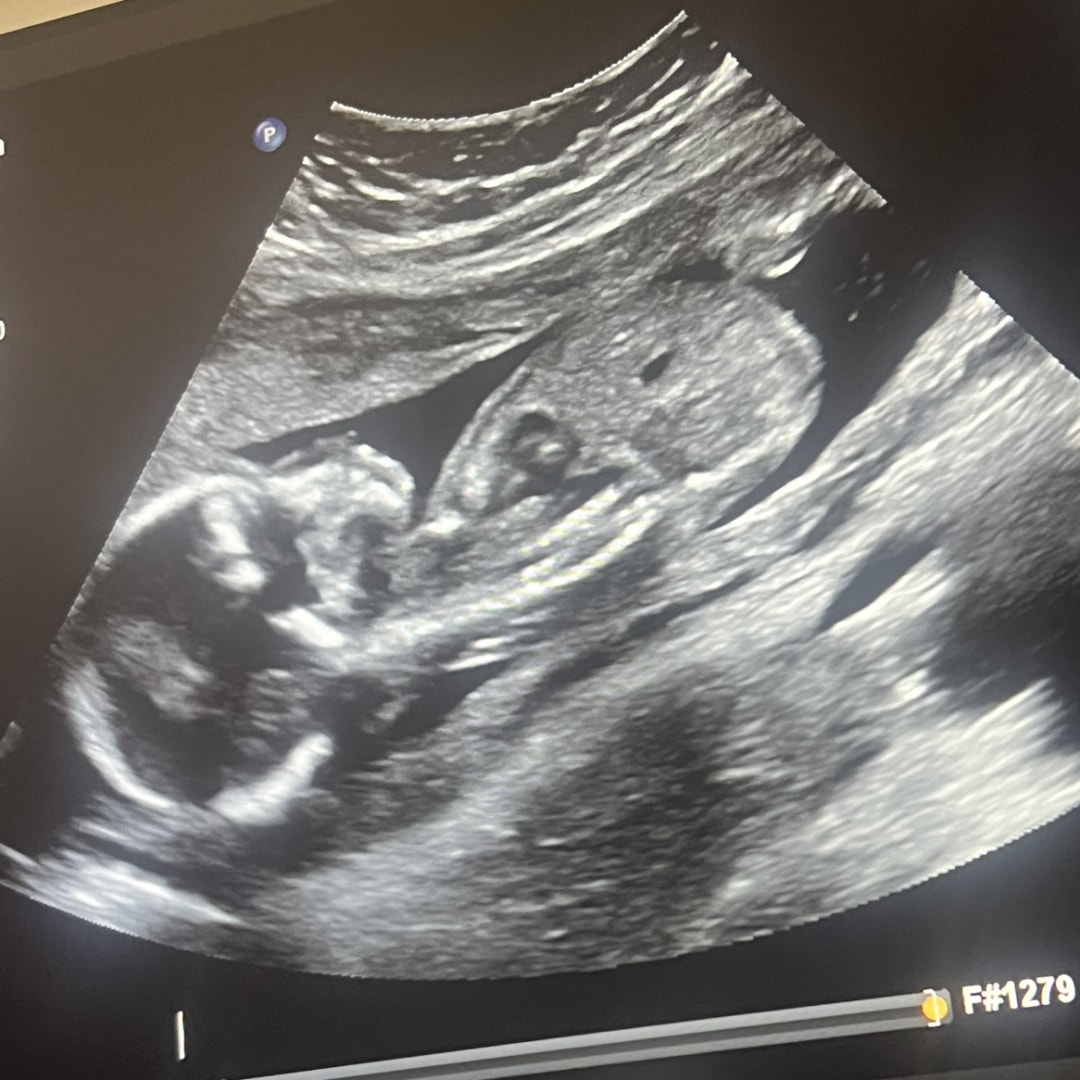 Photo shared by Jaya for their Babylist baby registry.