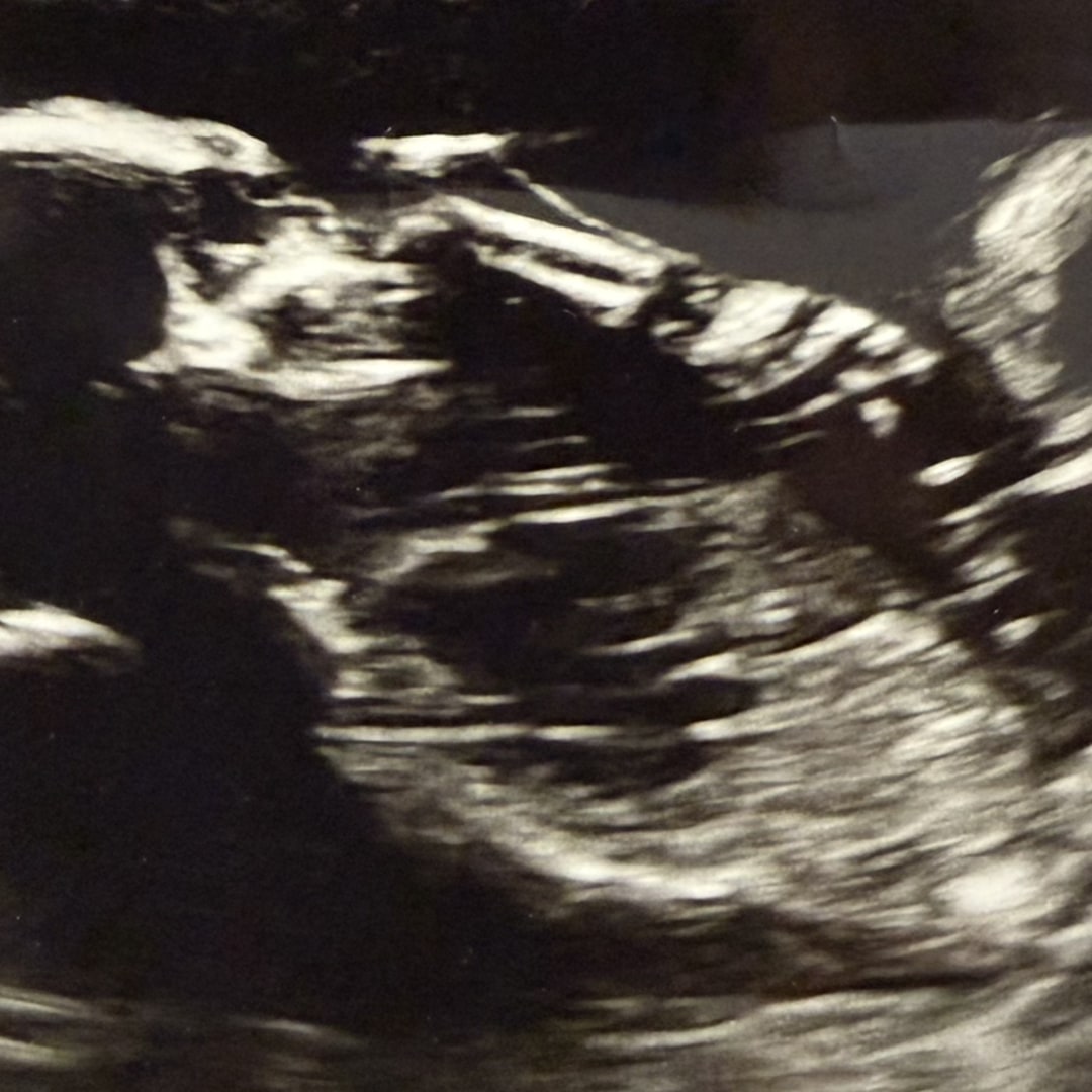 Photo shared by Meaghan for their Babylist baby registry.