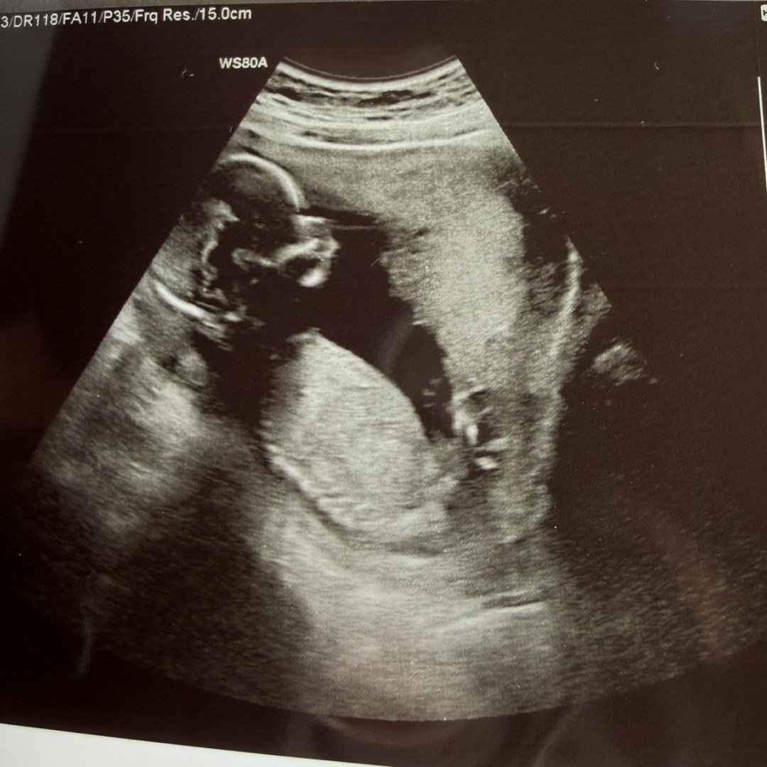 Photo shared by Amanda for their Babylist baby registry.