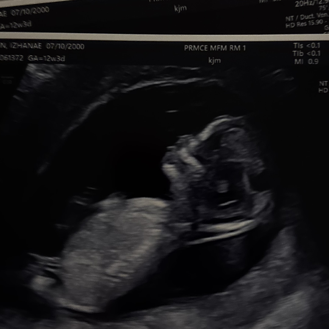 Photo shared by Izhanae for their Babylist baby registry.