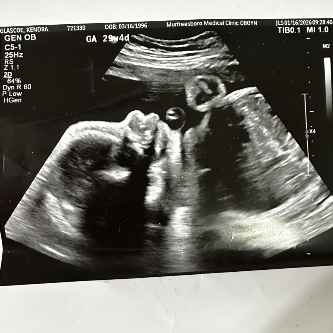 Photo shared by Kendra for their Babylist baby registry.