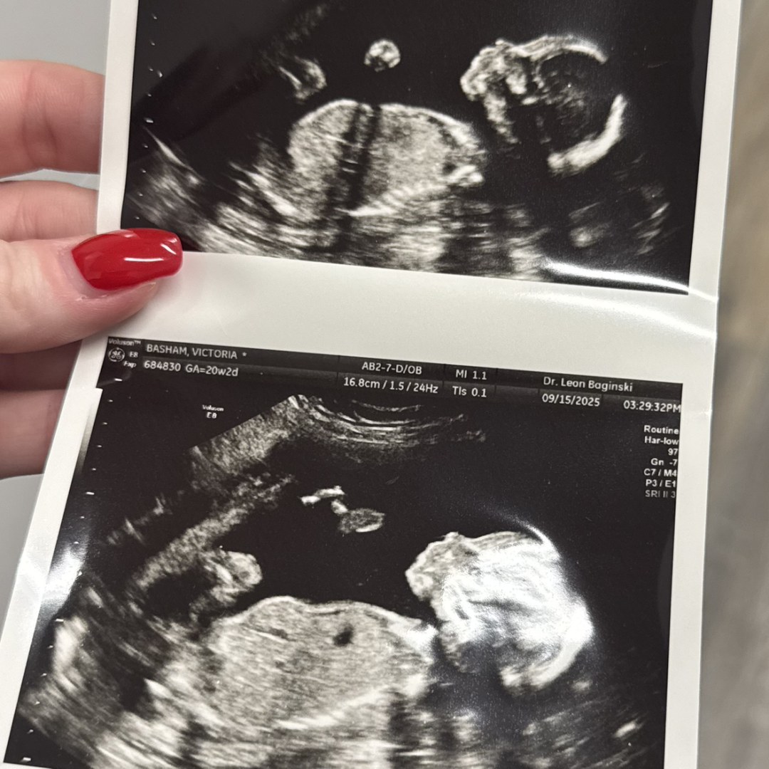 Photo shared by Victoria for their Babylist baby registry.