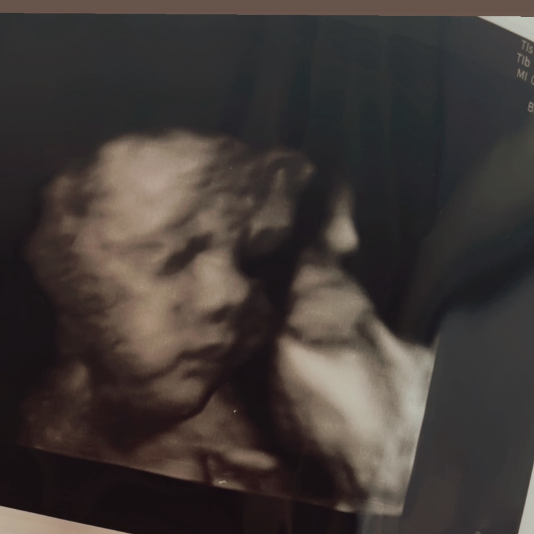 Photo shared by Makayla for their Babylist baby registry.