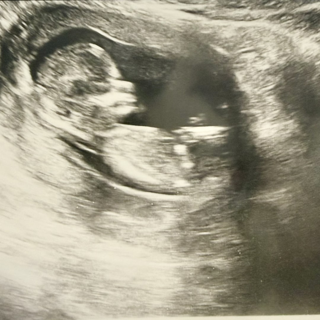 Photo shared by Haley for their Babylist baby registry.