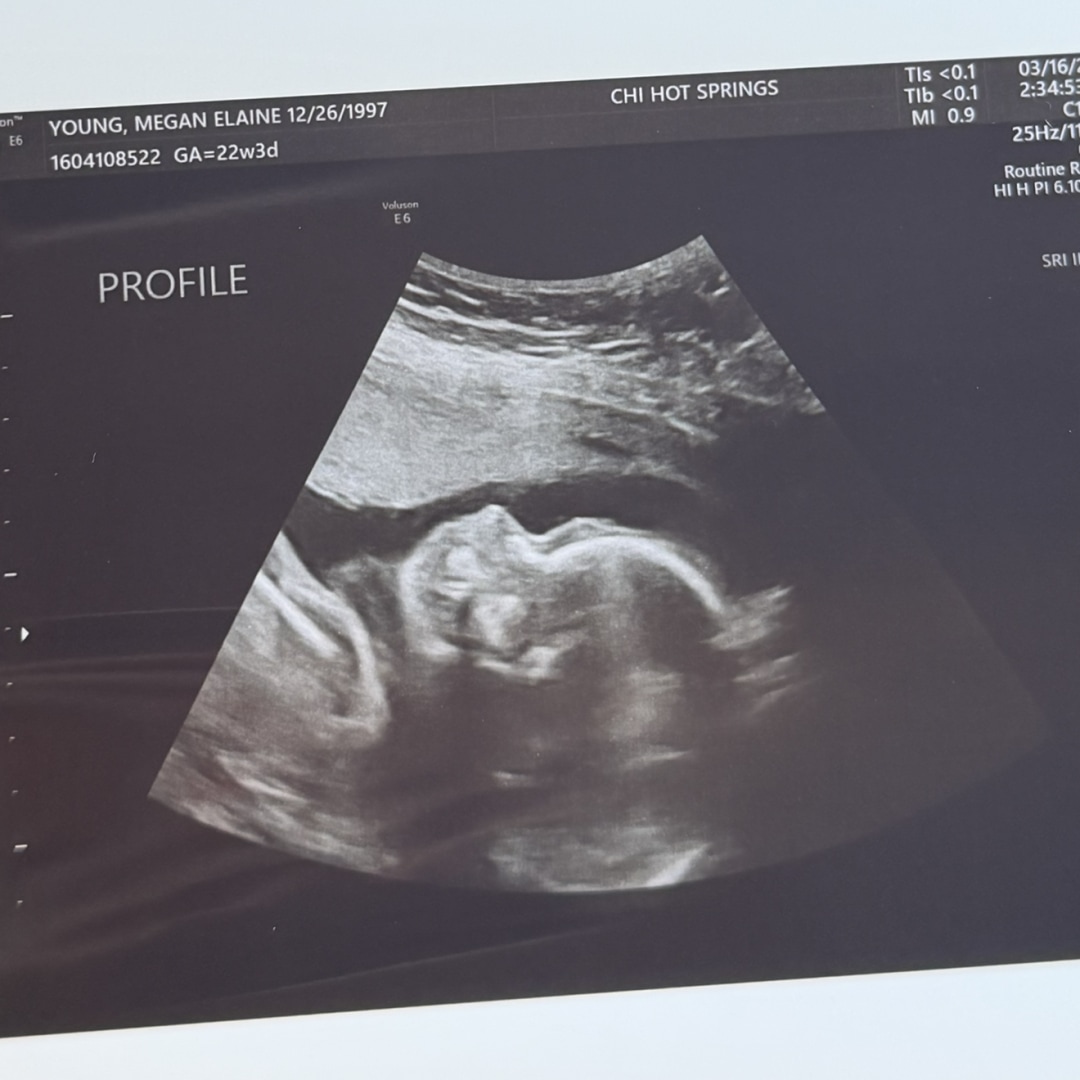 Photo shared by Megan for their Babylist baby registry.