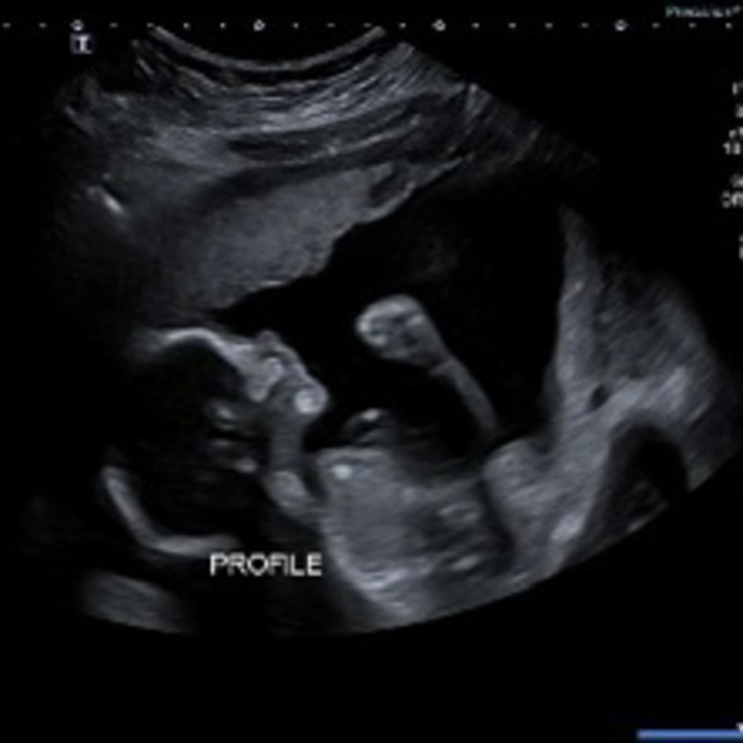 Photo shared by Zoe for their Babylist baby registry.