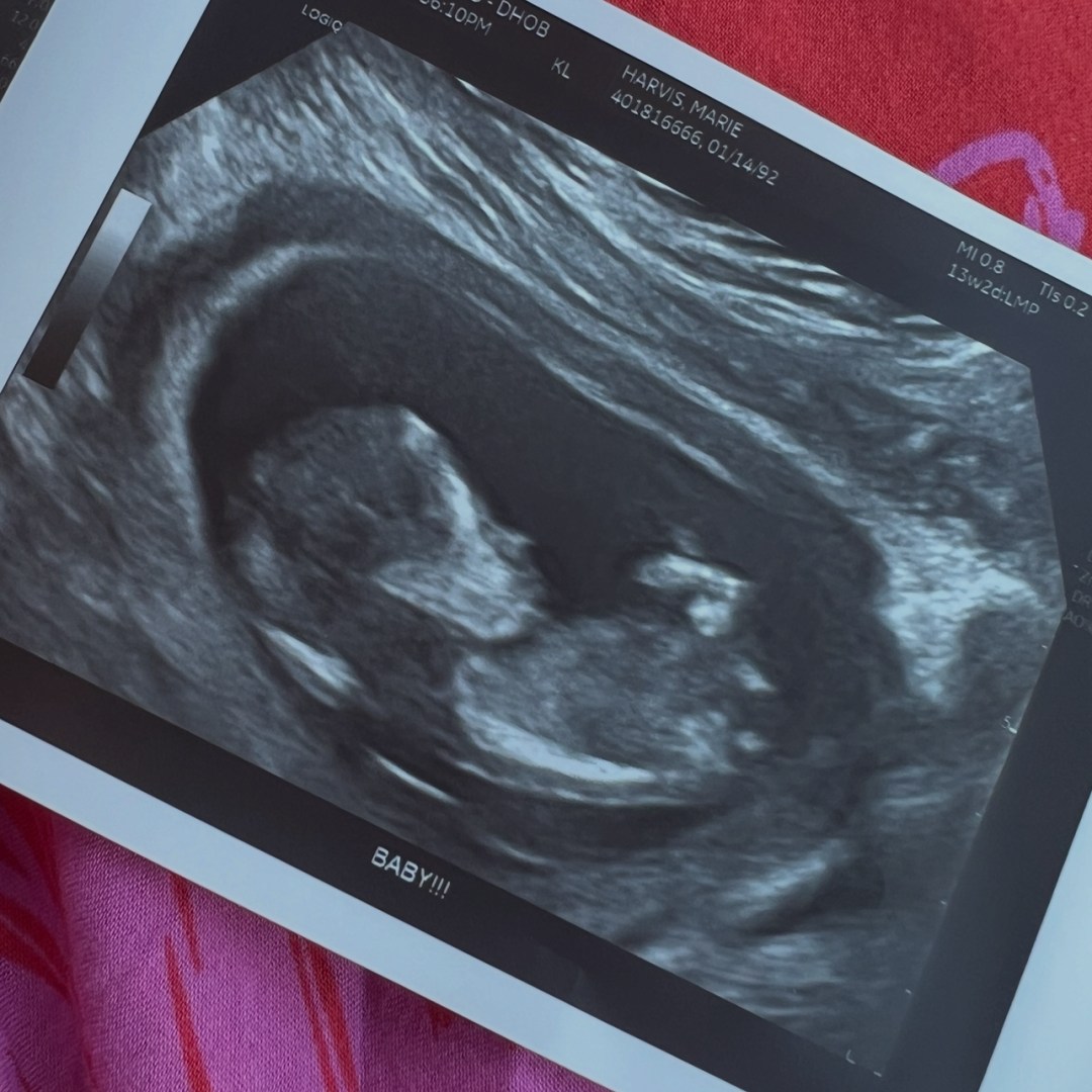 Photo shared by Marie for their Babylist baby registry.