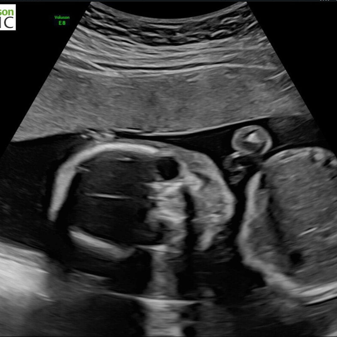 Photo shared by Shannon for their Babylist baby registry.