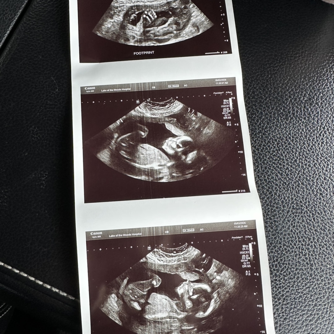 Photo shared by Taylor for their Babylist baby registry.