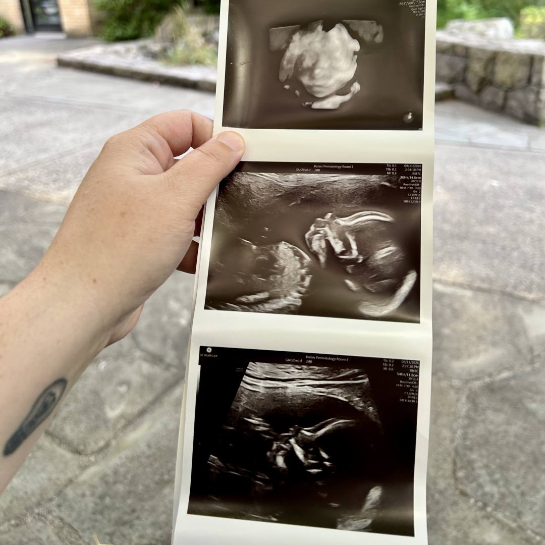 Photo shared by Hope for their Babylist baby registry.