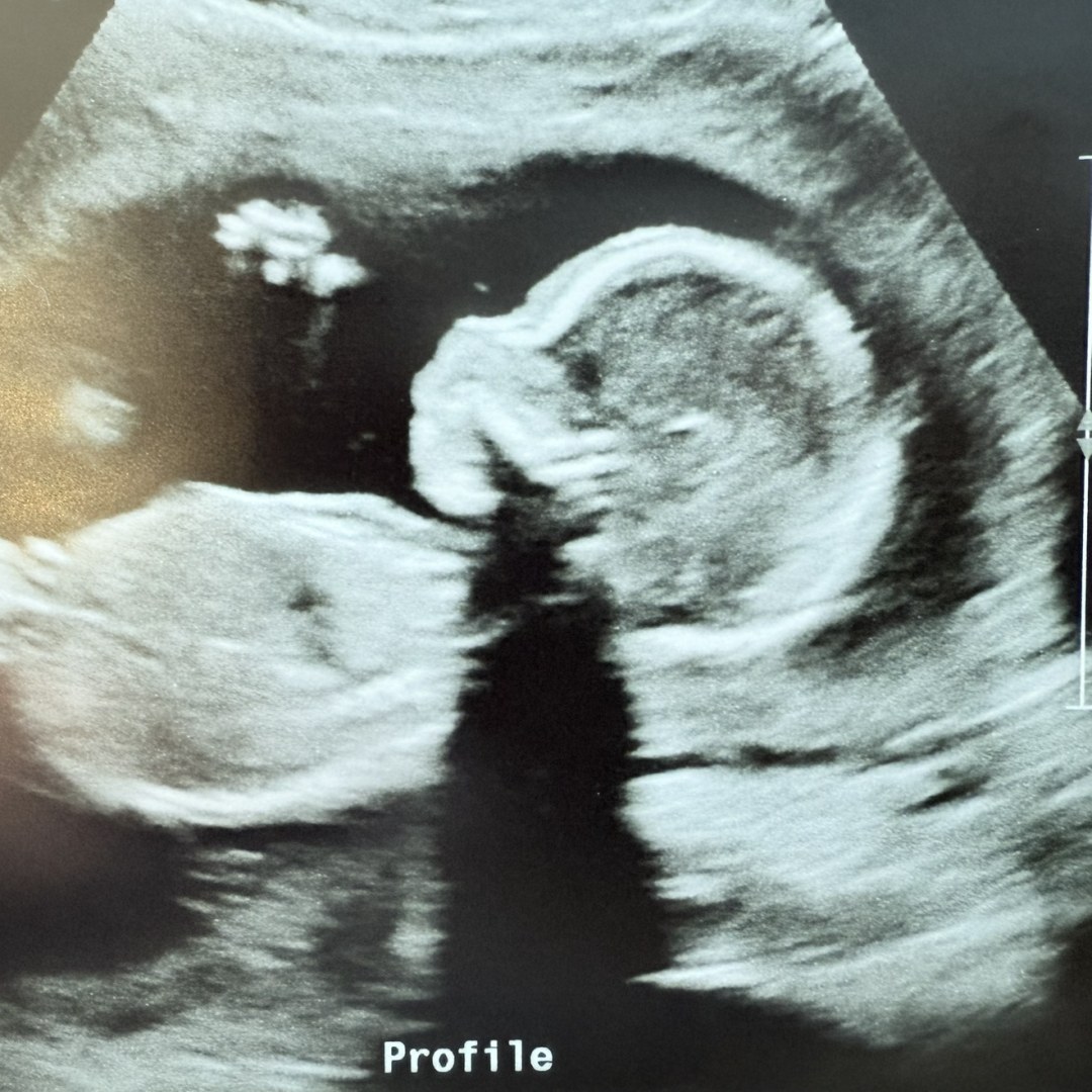 Photo shared by Nerissa for their Babylist baby registry.
