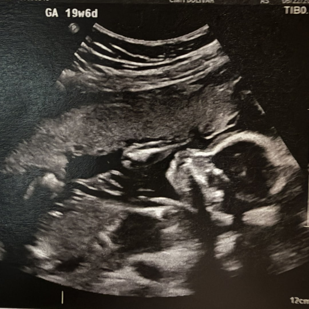 Photo shared by Lauren for their Babylist baby registry.