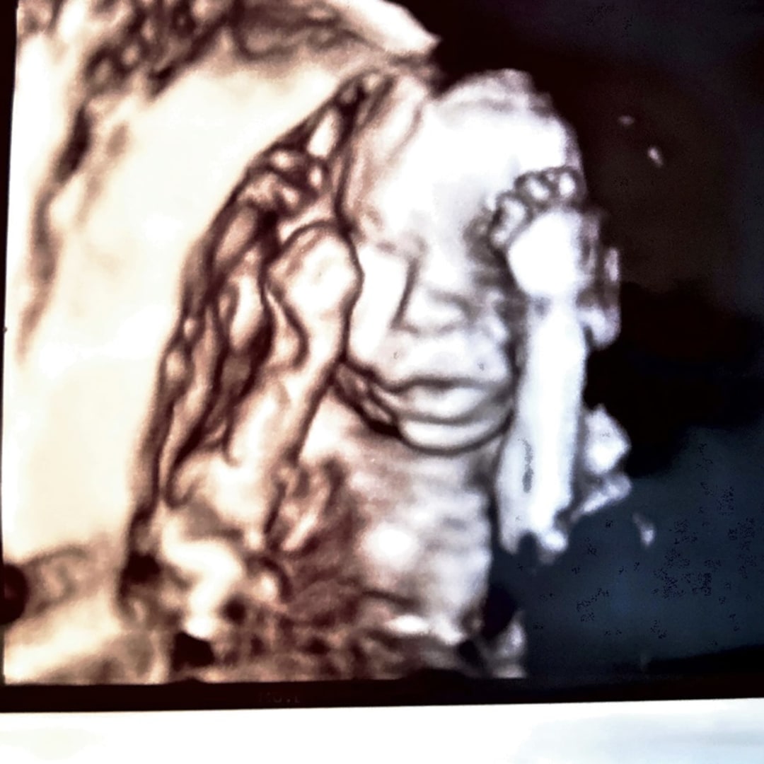 Photo shared by Emma for their Babylist baby registry.