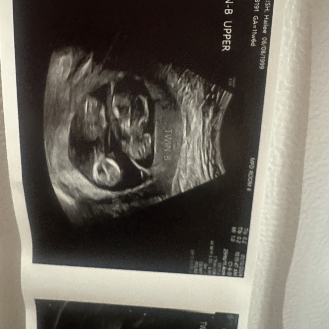 Photo shared by Hailee for their Babylist baby registry.