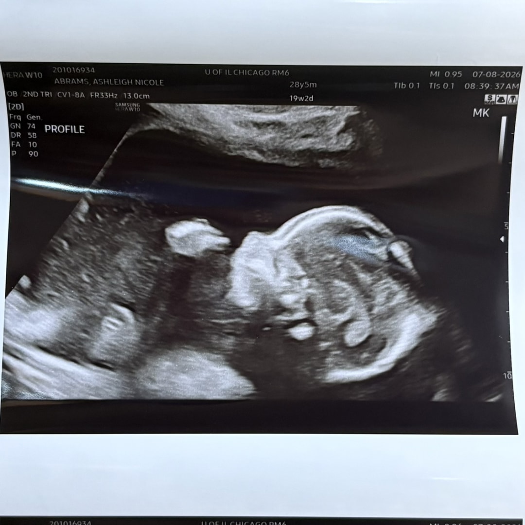Photo shared by Ashleigh for their Babylist baby registry.