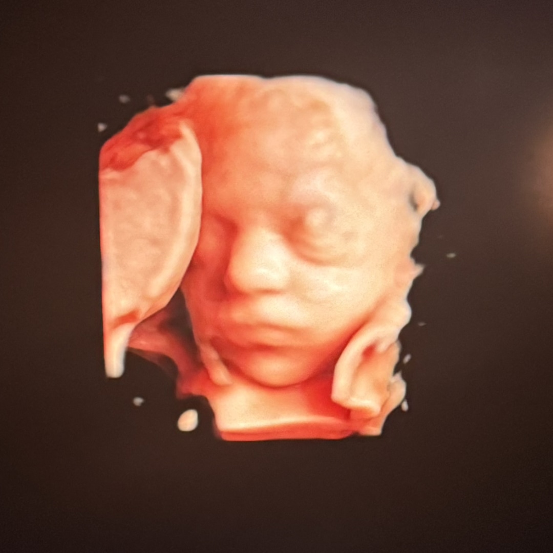 Photo shared by Alexia for their Babylist baby registry.