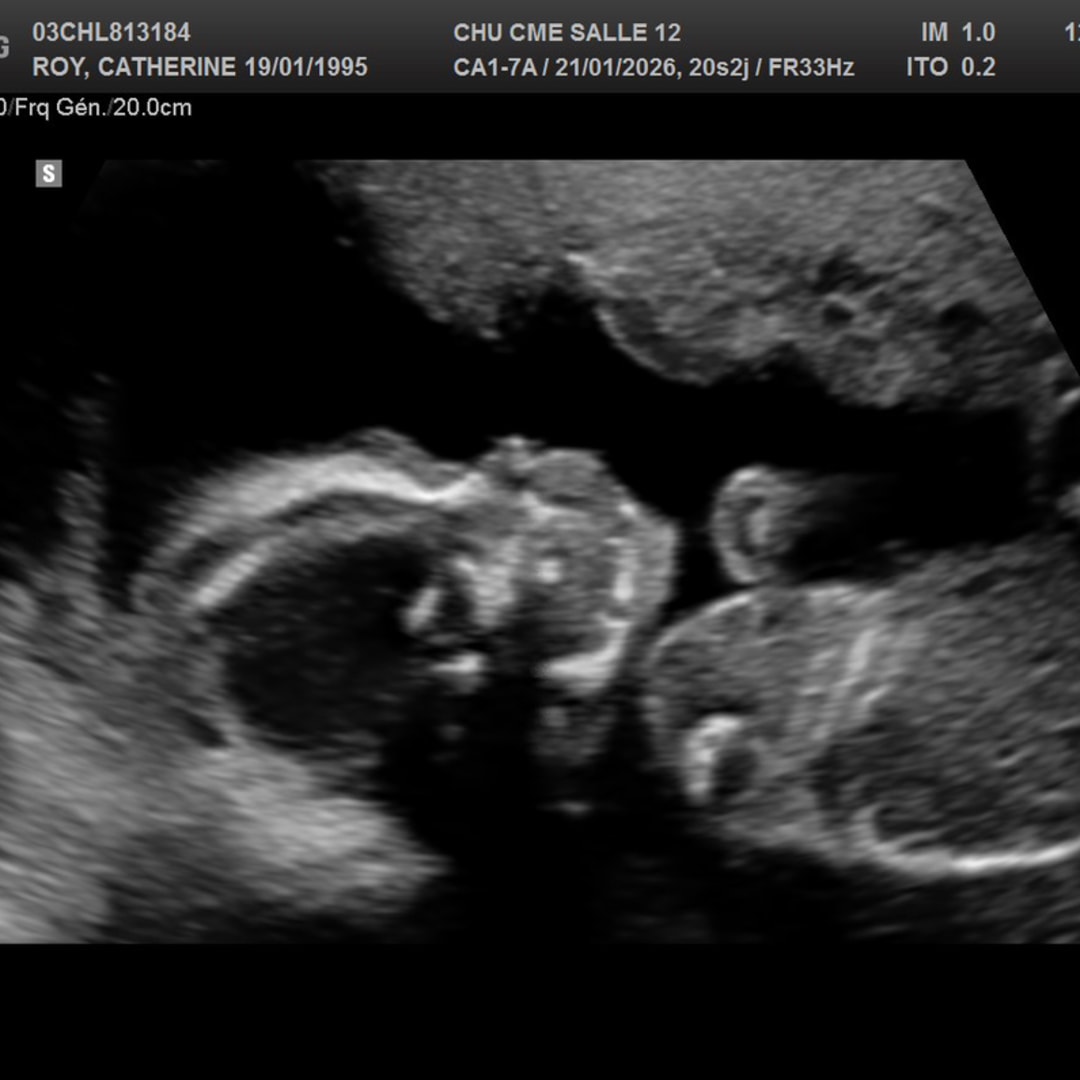 Photo shared by Catherine for their Babylist baby registry.