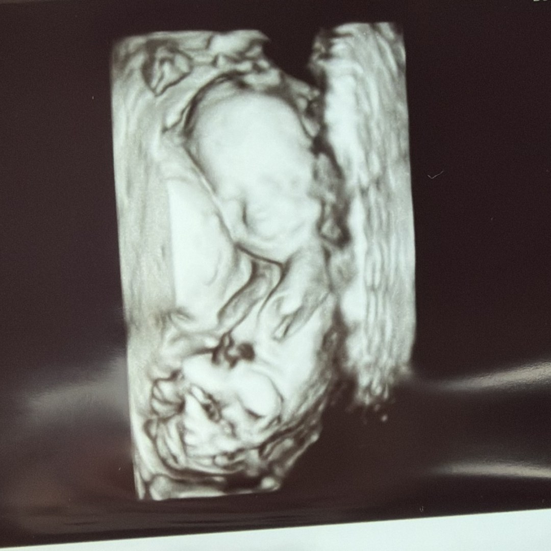 Photo shared by Courtney for their Babylist baby registry.