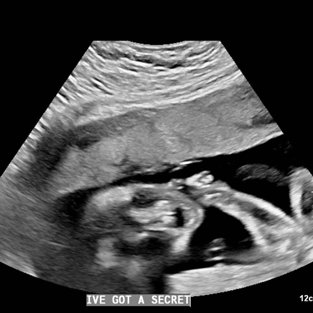 Photo shared by Veronica for their Babylist baby registry.