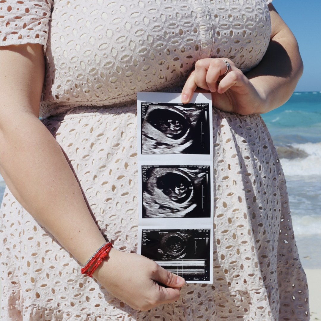 Photo shared by Cheyenne for their Babylist baby registry.