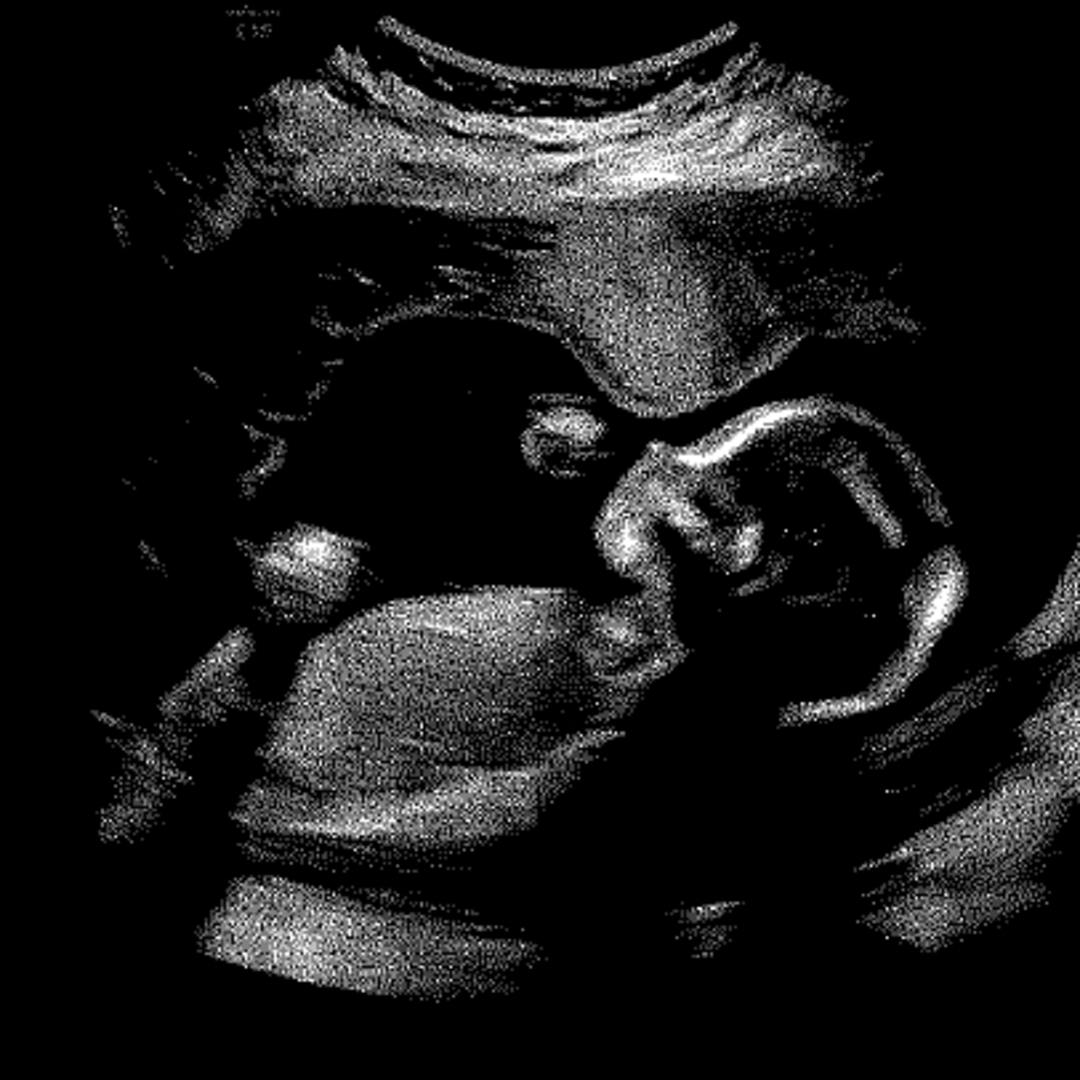 Photo shared by Michelle for their Babylist baby registry.