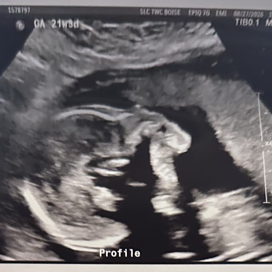 Photo shared by Mattie for their Babylist baby registry.