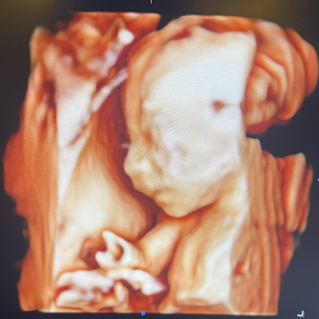 Photo shared by Jessie for their Babylist baby registry.