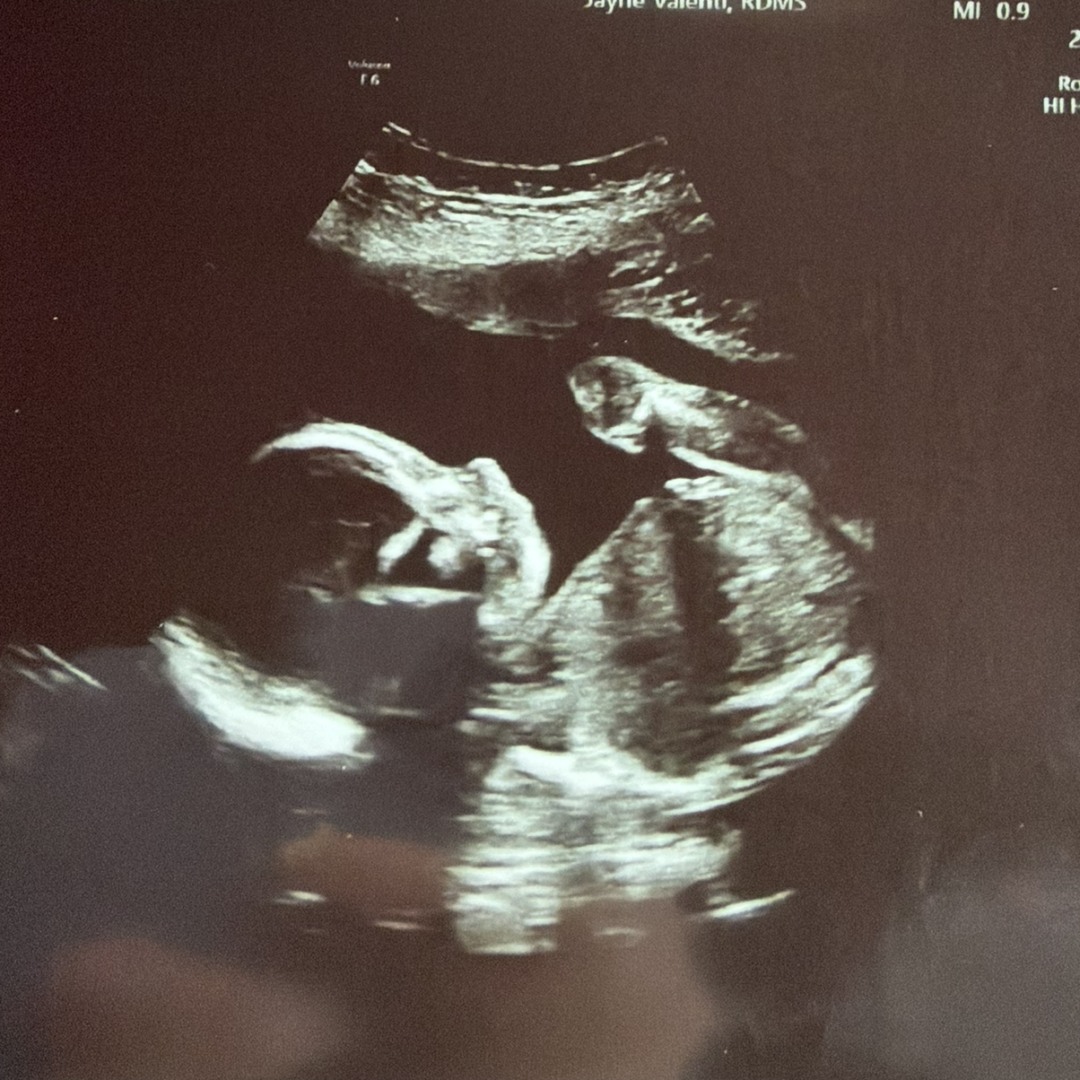 Photo shared by Sara for their Babylist baby registry.