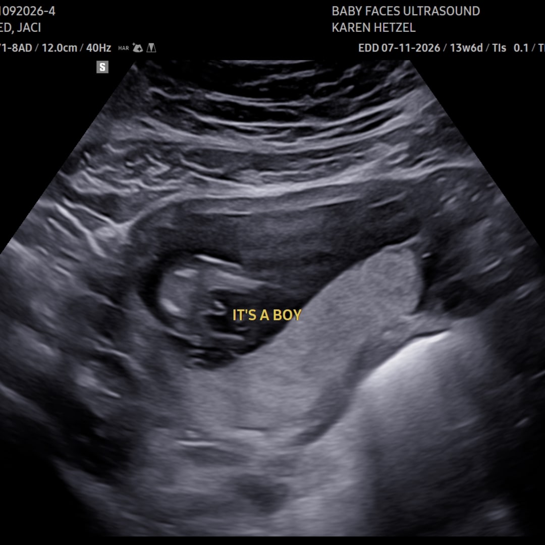 Photo shared by Jaci for their Babylist baby registry.