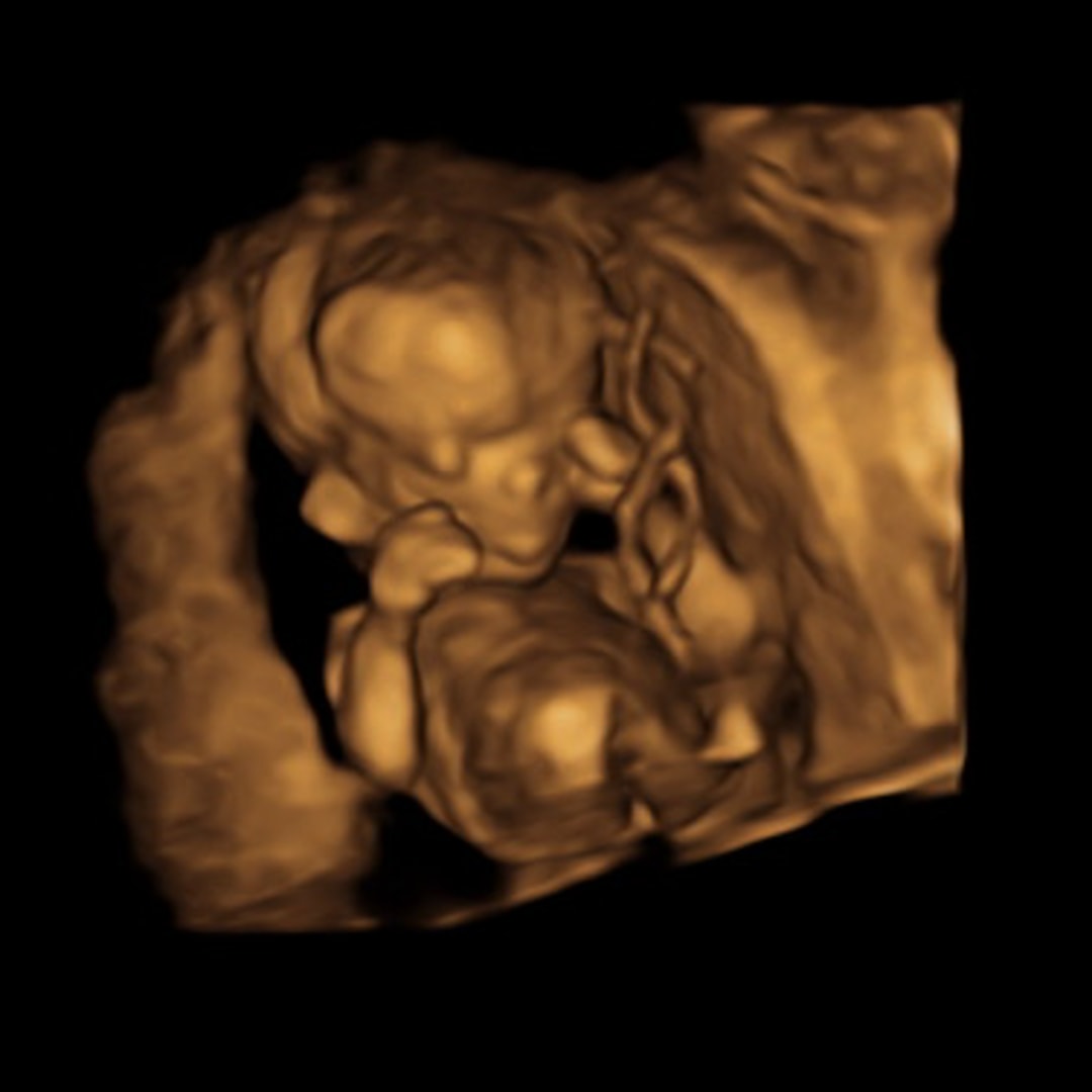 Photo shared by Trinity for their Babylist baby registry.