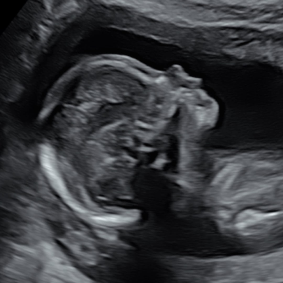 Photo shared by Sarah for their Babylist baby registry.