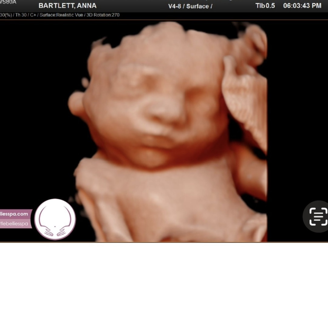 Photo shared by Anna for their Babylist baby registry.