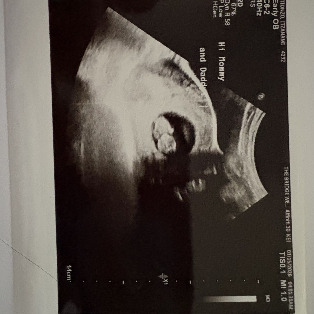 Photo shared by Itzanami for their Babylist baby registry.