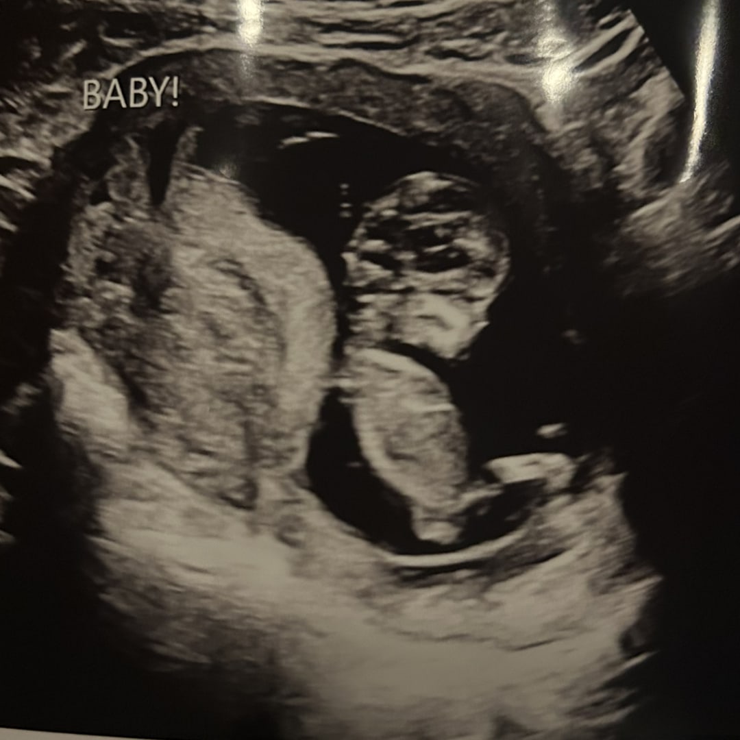 Photo shared by Autumn for their Babylist baby registry.