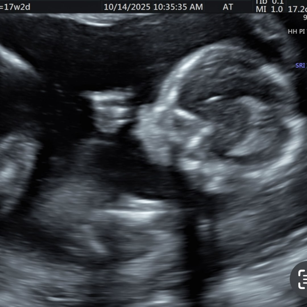 Photo shared by Taylor for their Babylist baby registry.