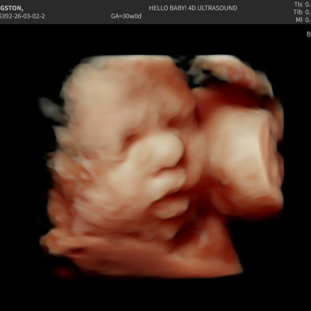 Photo shared by Abigail for their Babylist baby registry.