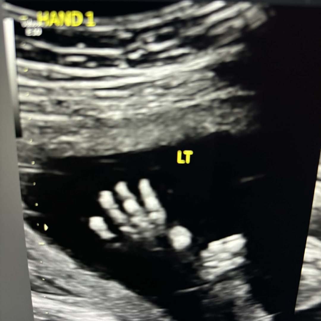 Photo shared by Katrina for their Babylist baby registry.