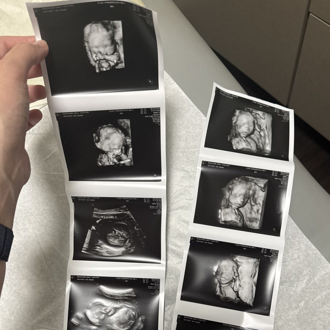 Photo shared by Emily for their Babylist baby registry.