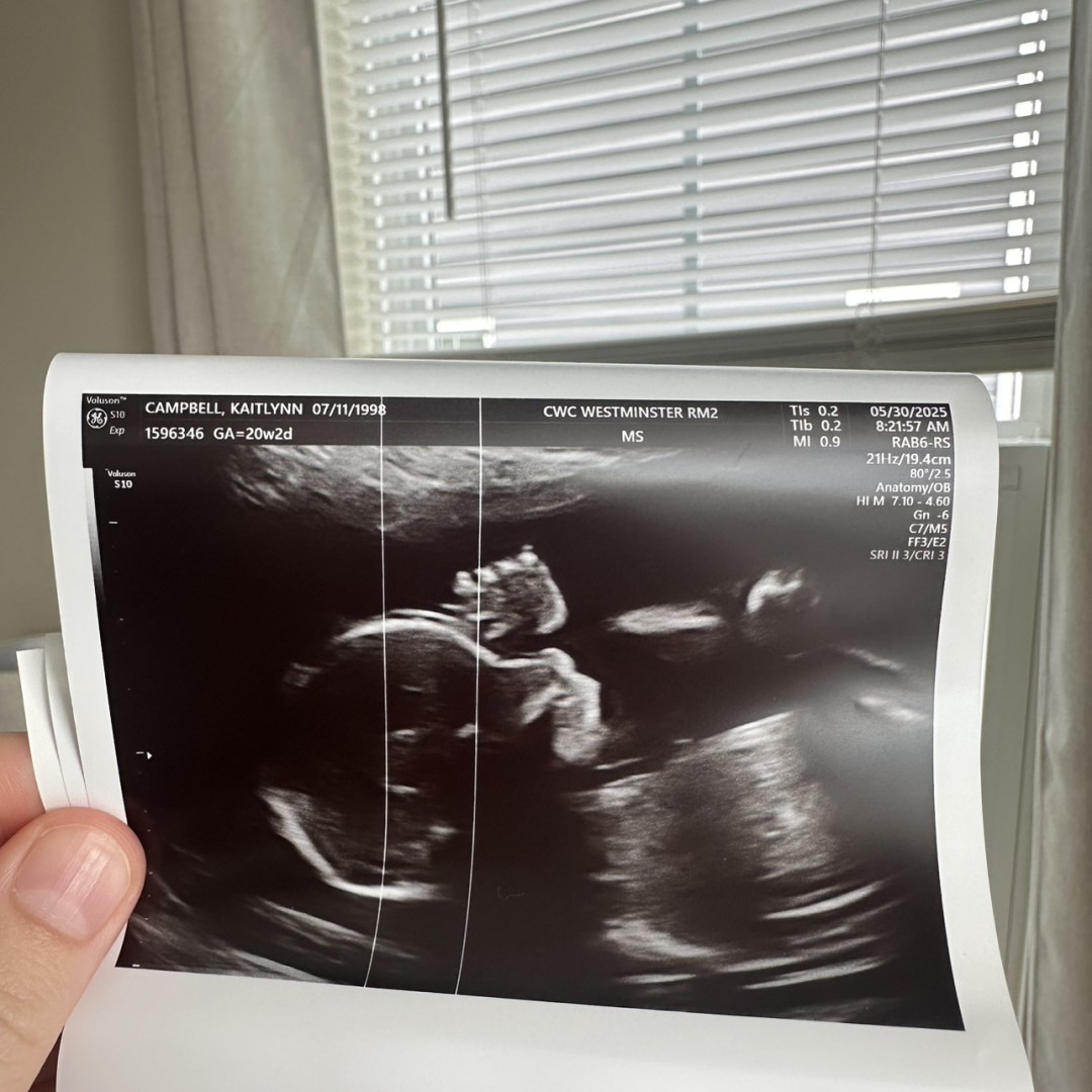 Photo shared by Kaitlynn for their Babylist baby registry.