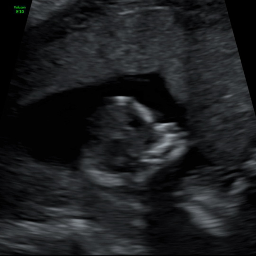 Photo shared by Grace for their Babylist baby registry.