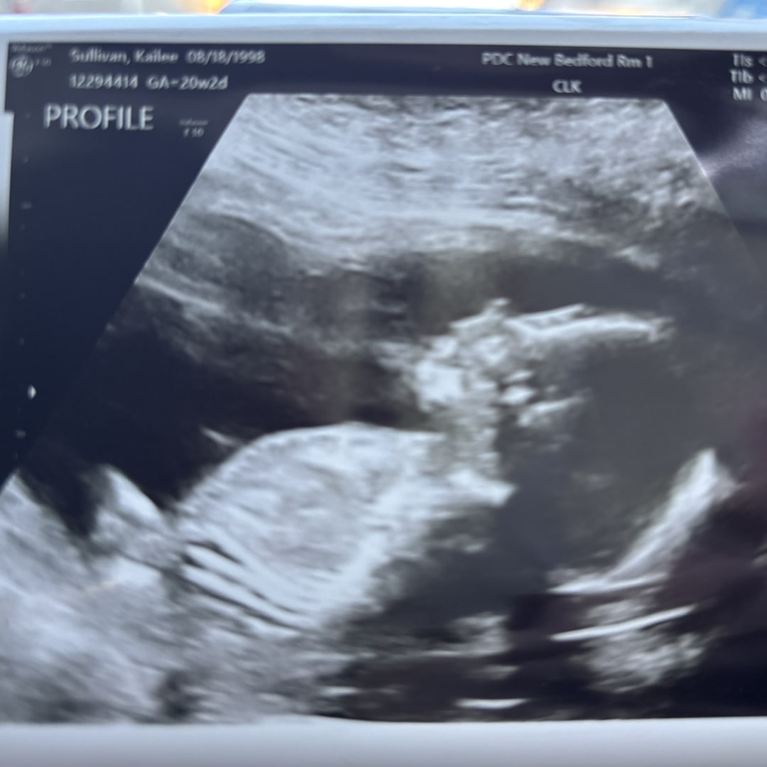 Photo shared by Kailee for their Babylist baby registry.