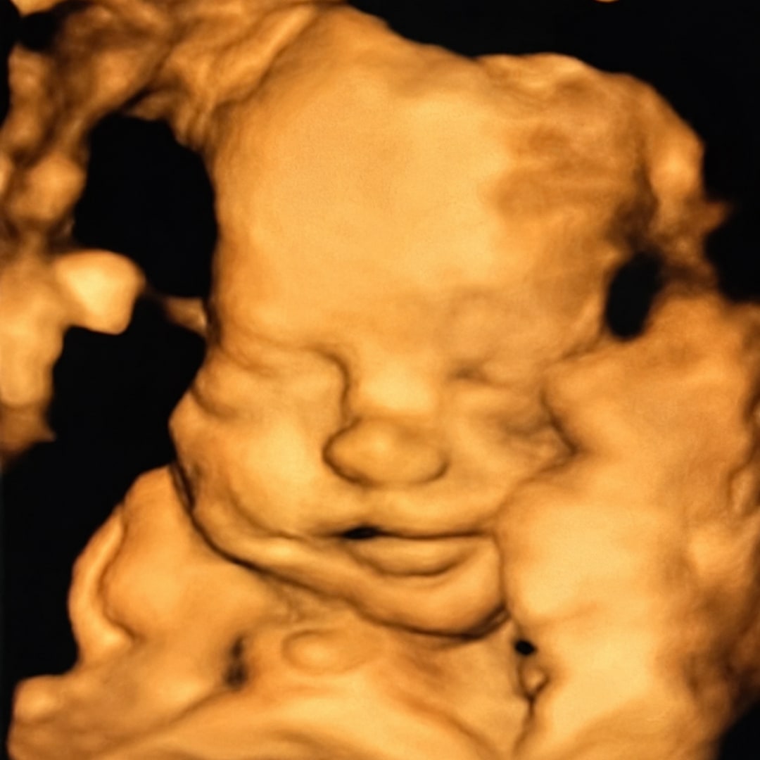 Photo shared by Allison for their Babylist baby registry.