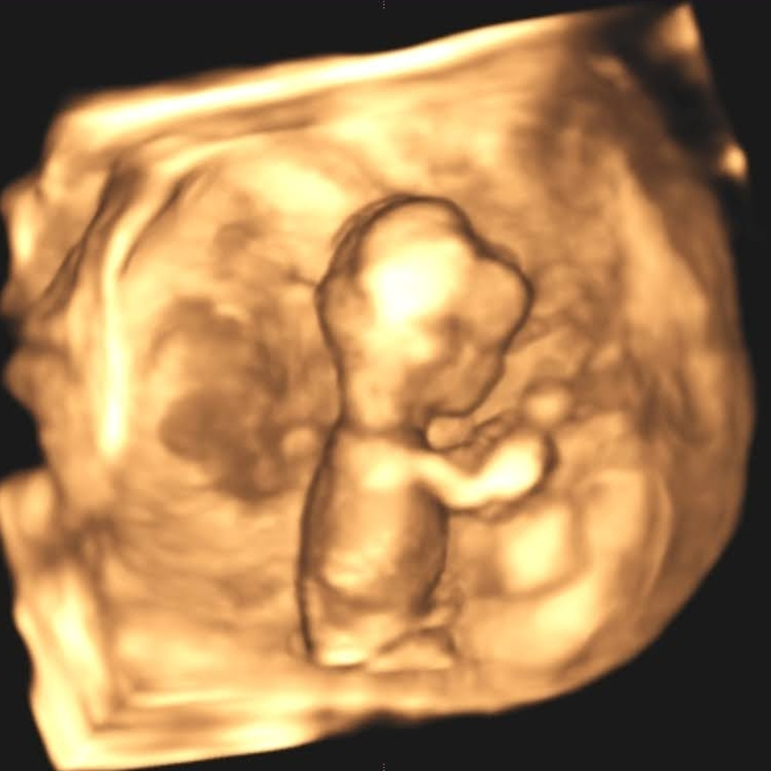 Photo shared by Alberto for their Babylist baby registry.