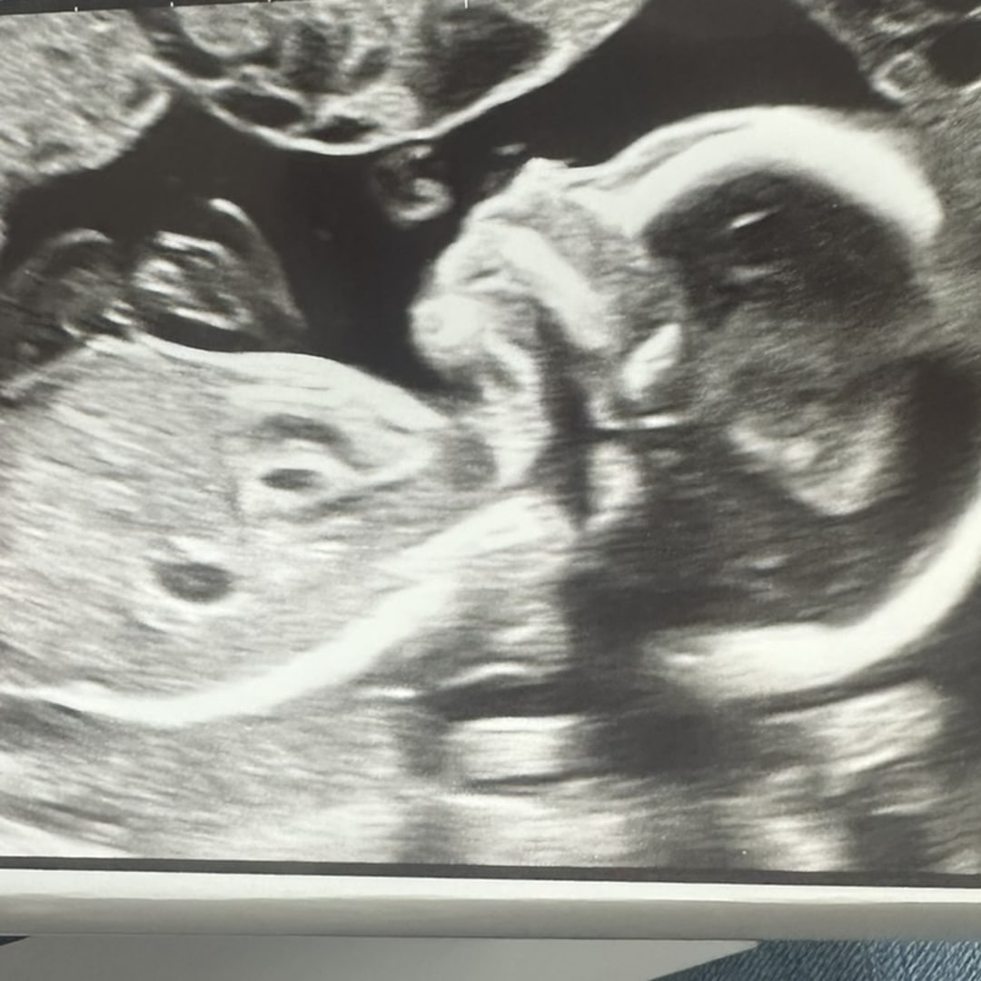 Photo shared by Sabrina for their Babylist baby registry.