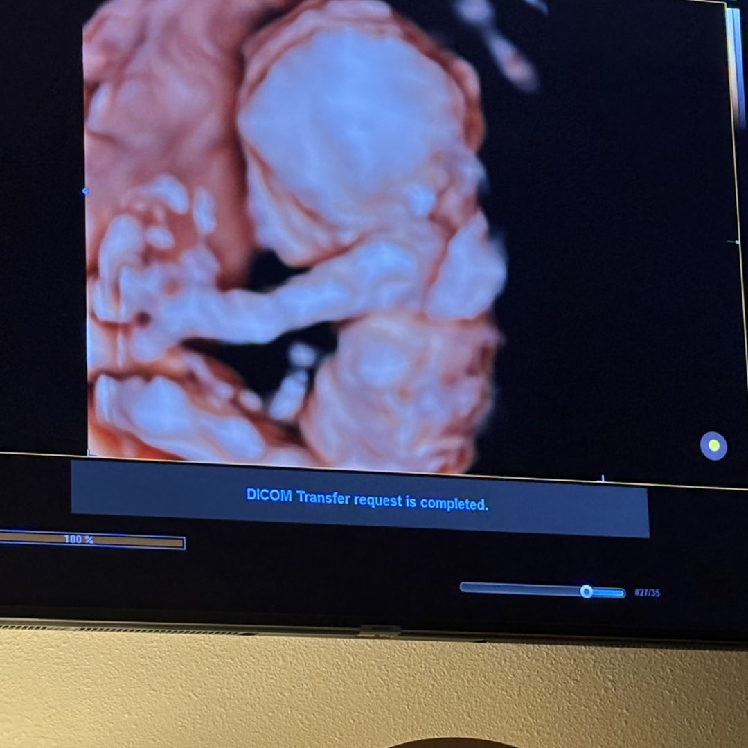 Photo shared by Natalie for their Babylist baby registry.