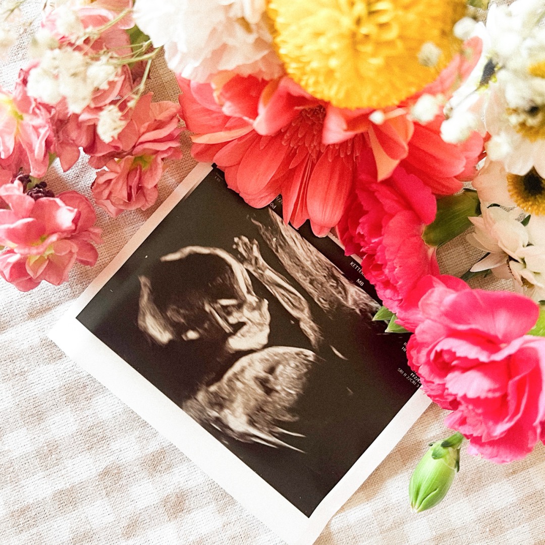 Photo shared by Jayda for their Babylist baby registry.