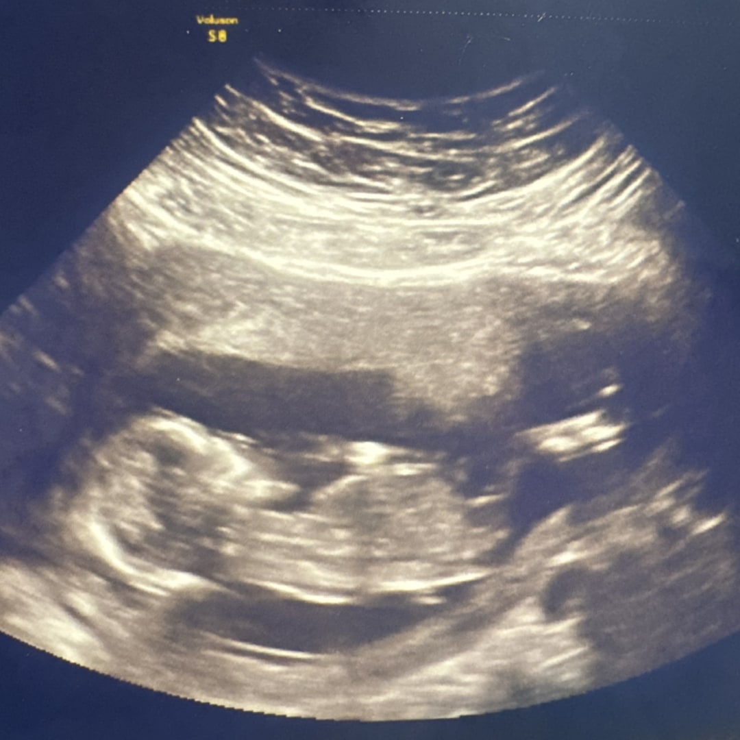 Photo shared by Victoria for their Babylist baby registry.